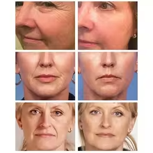 Collagen Secret™ crema facial colágeno